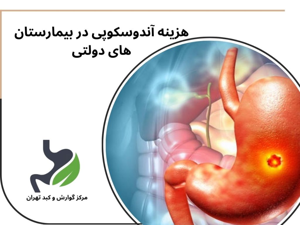 هزینه آندوسکوپی در بیمارستان های دولتی