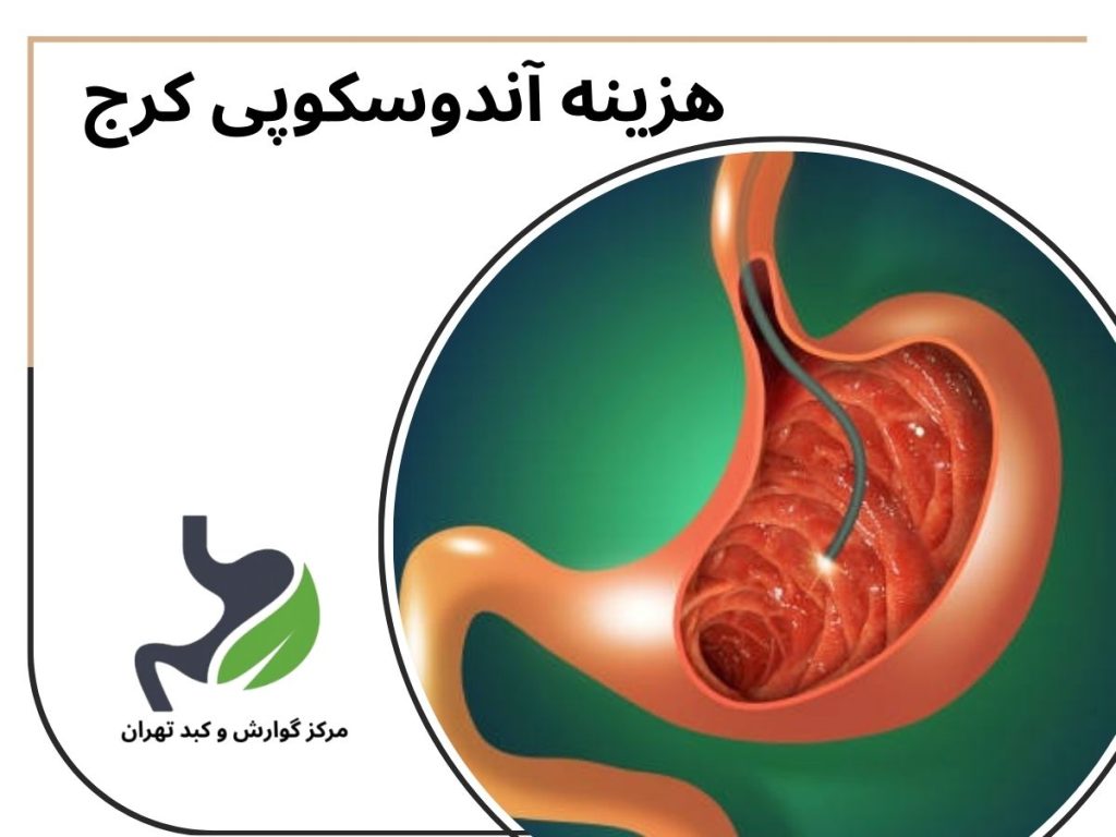 هزینه آندوسکوپی کرج