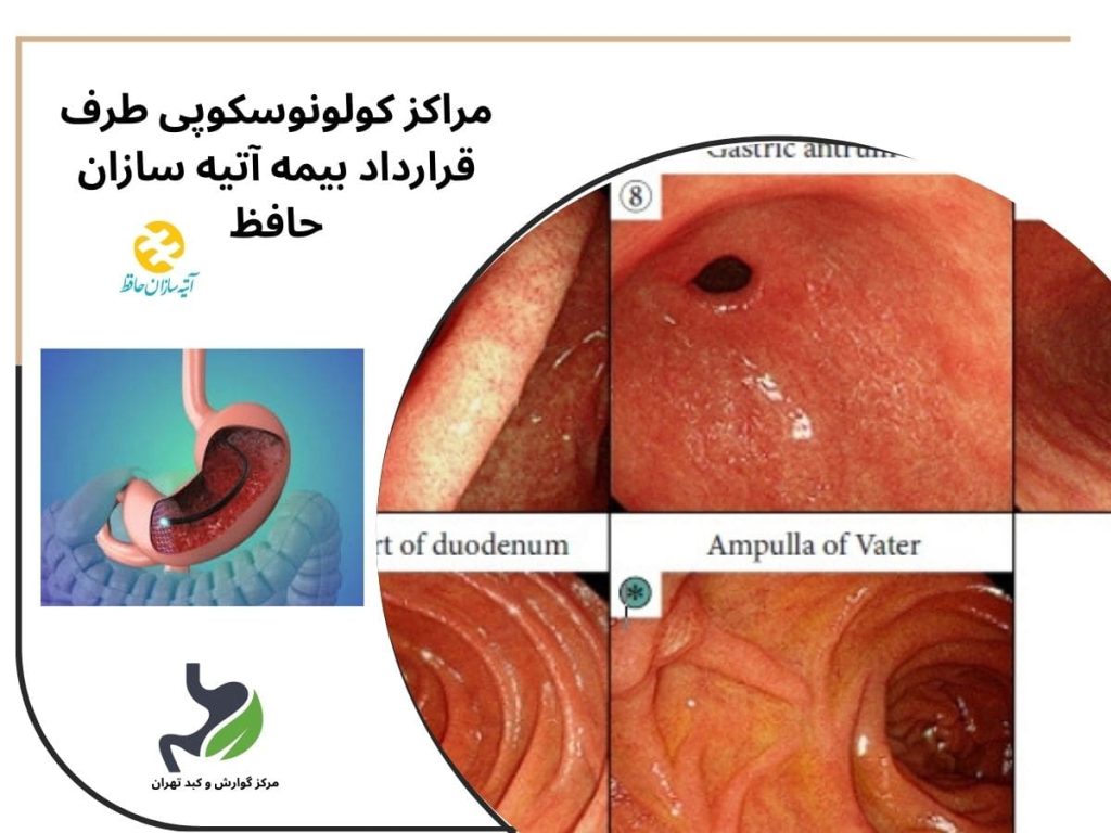 مراکز کولونوسکوپی طرف قرارداد بیمه آتیه سازان حافظ