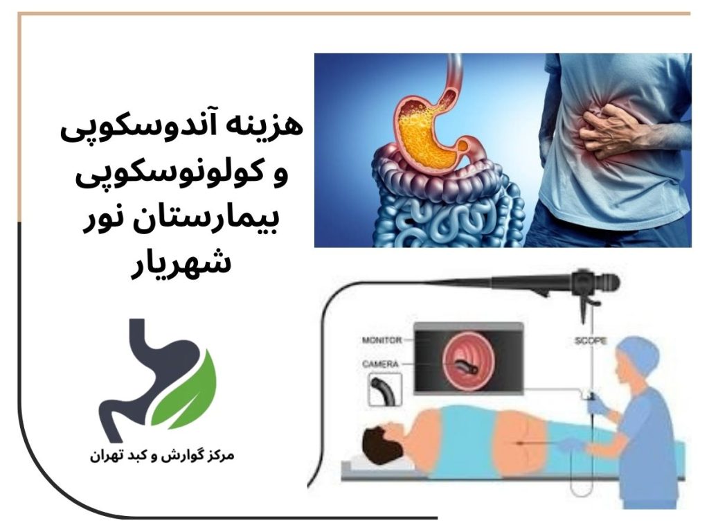 هزینه آندوسکوپی و کولونوسکوپی بیمارستان نور شهریار