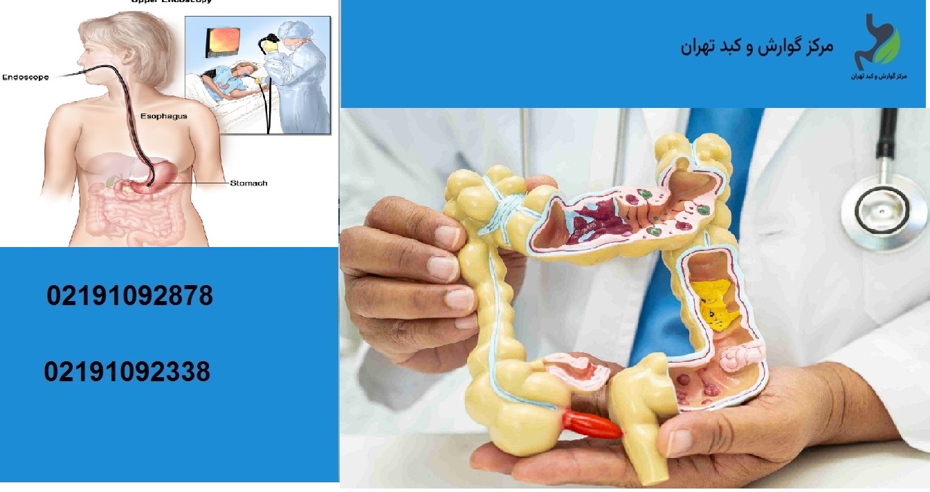 فوق تخصص گوارش خانم در غرب تهران