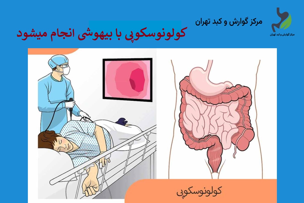 کولونوسکوپی با بیهوشی انجام میشود