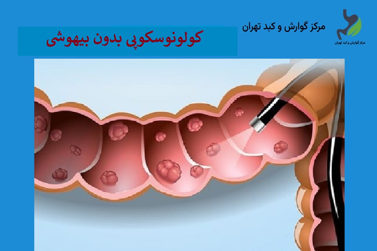 کولونوسکوپی بدون بیهوشی