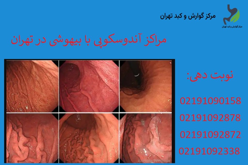 مراکز آندوسکوپی با بیهوشی در تهران + معرفی مراکز معتبر