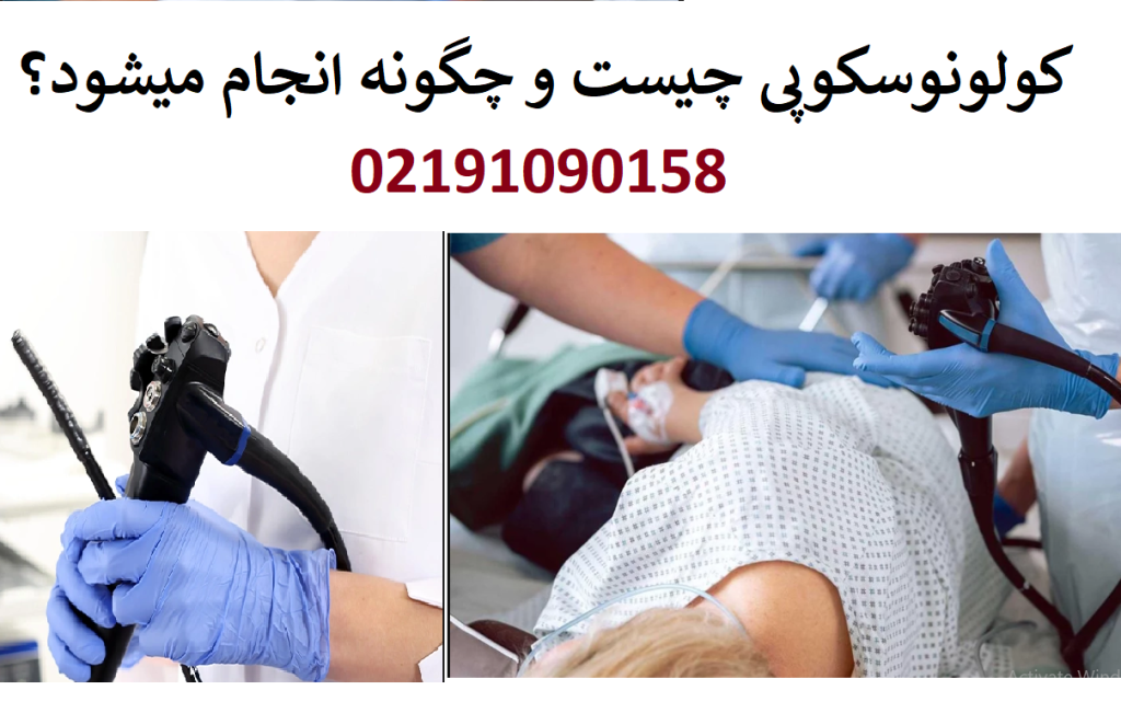 کولونوسکوپی چیست و چگونه انجام میشود؟ صفر تا 100 کولونوسکوپی