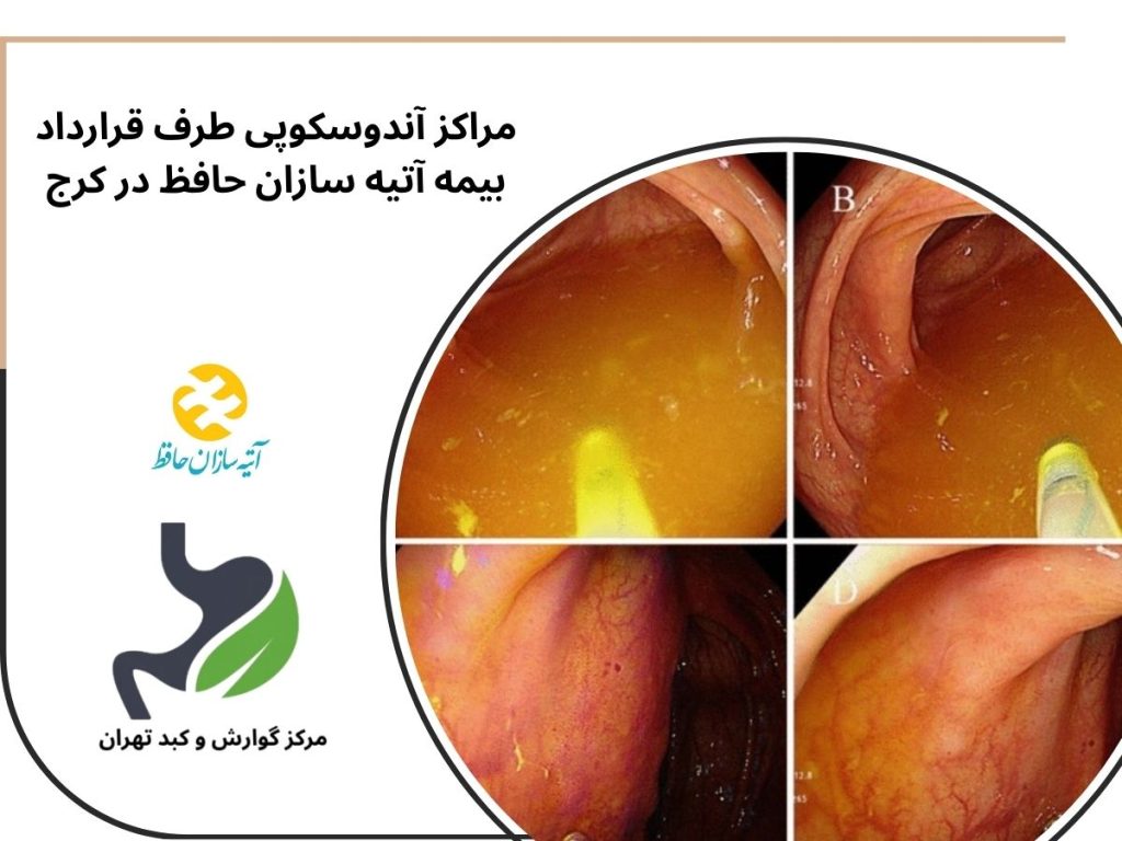 مراکز آندوسکوپی طرف قرارداد بیمه آتیه سازان حافظ در کرج