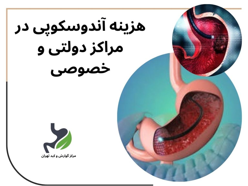 هزینه آندوسکوپی در مراکز دولتی ,خصوصی قیمت کولونوسکوپی روده