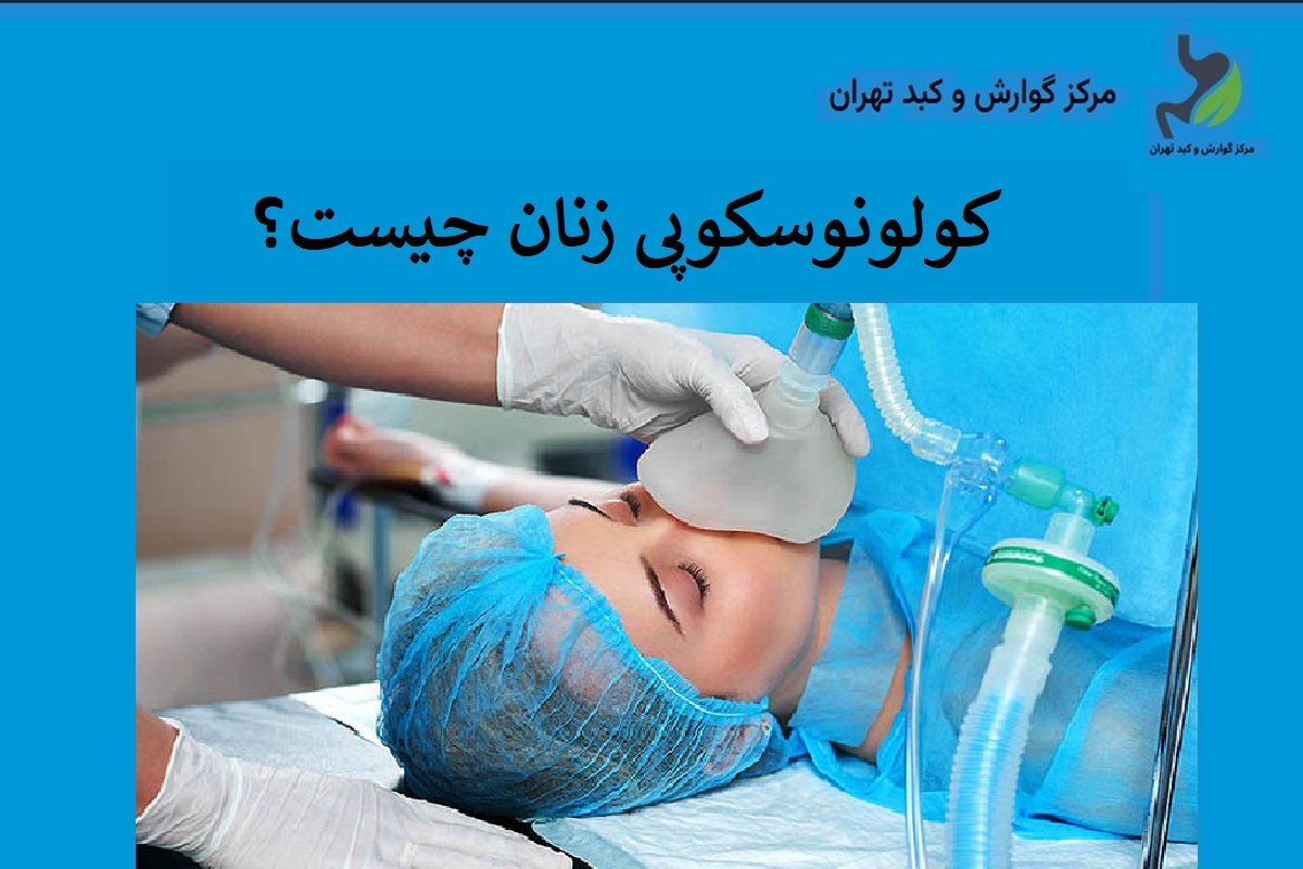 کولونوسکوپی زنان چیست؟