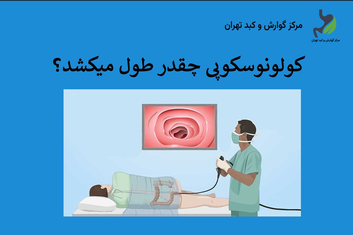 کولونوسکوپی چقدر طول میکشد؟
