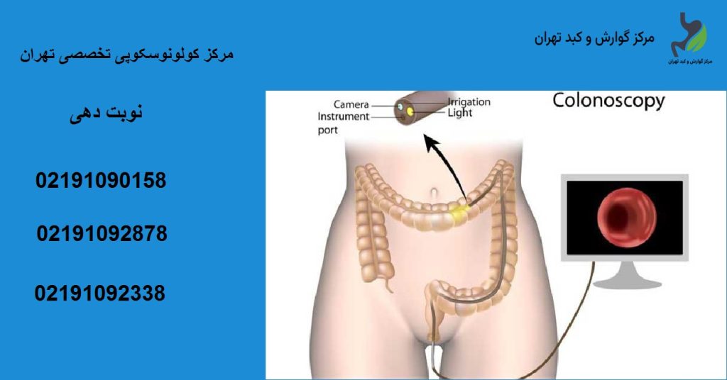 کولونوسکوپی تهران