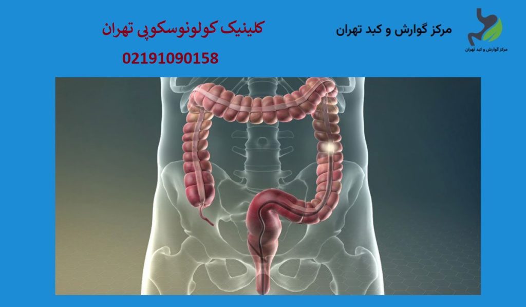 کلینیک کولونوسکوپی تهران | لیست بهترین مراکز تخصصی گوارش
