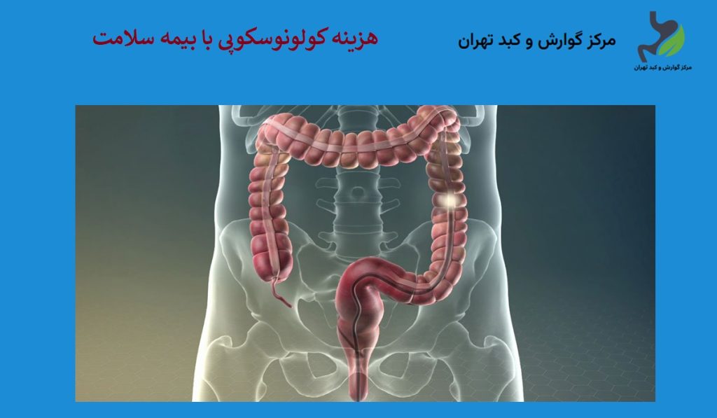 هزینه کولونوسکوپی با بیمه سلامت و خدمات درمانی 1404