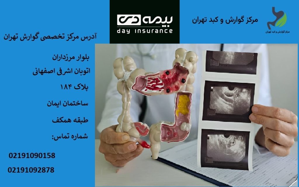 هزینه آندوسکوپی با بیمه دی در تهران | مراکز طرف قرارداد