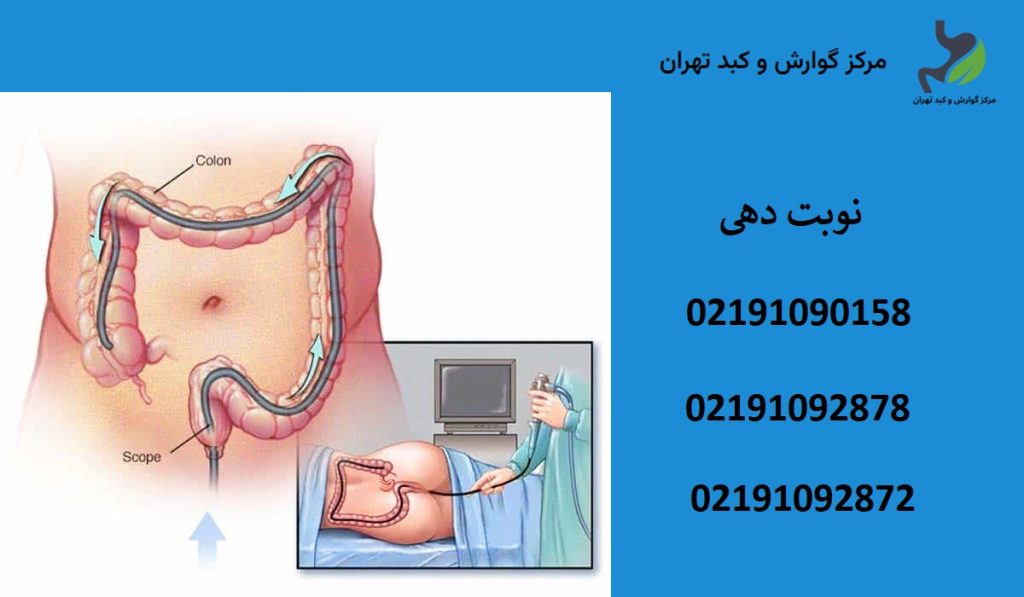 قیمت کولونوسکوپی با بیمه تامین اجتماعی