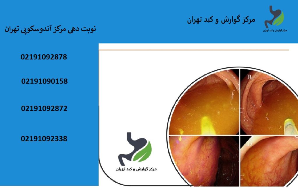 لیست 30 تایی بهترین مراکز آندوسکوپی مری در تهران و غرب تهران