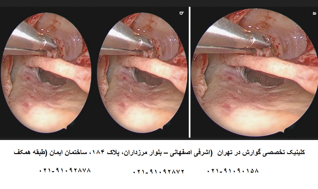 مراکز آندوسکوپی طرف قرارداد بیمه ایران در تهران