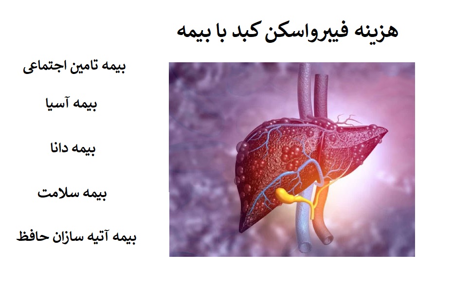 هزینه فیبرواسکن کبد با بیمه