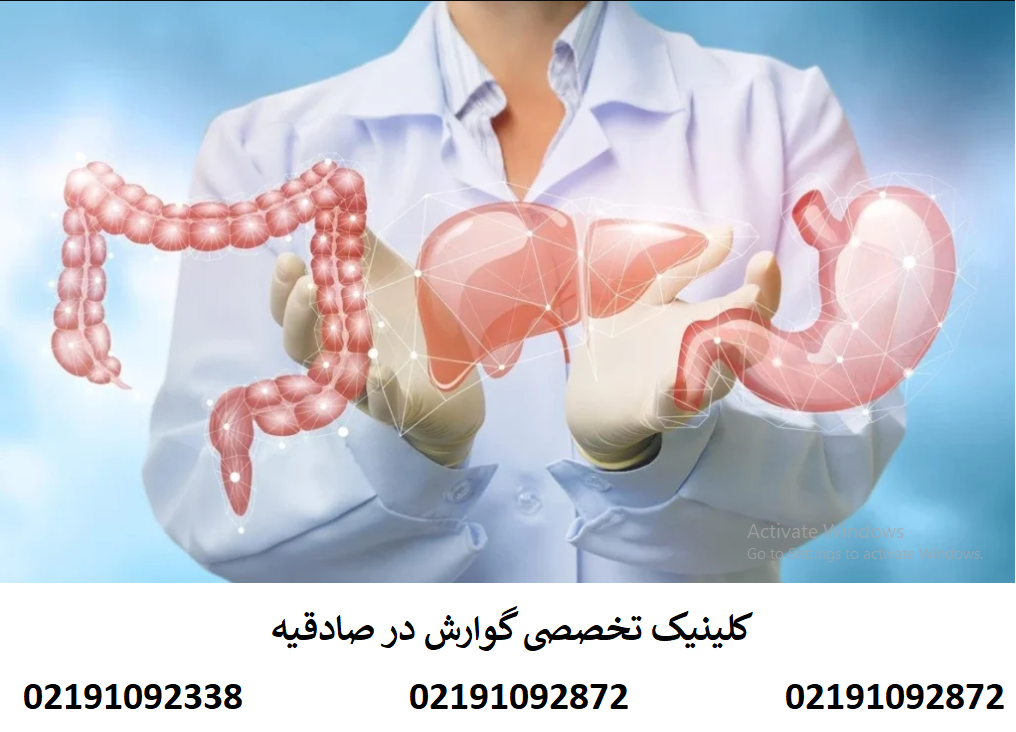 آندوسکوپی در صادقیه