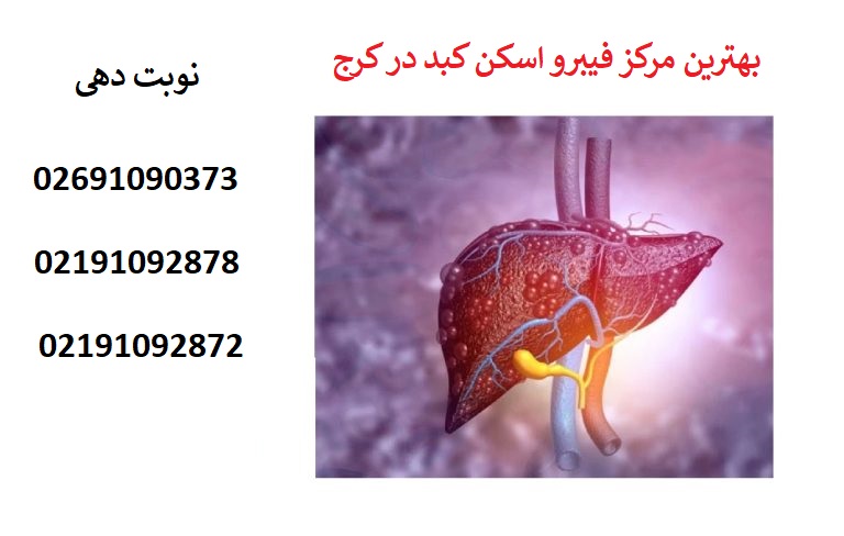 نوبت‌ دهی تلفنی مرکز فیبرواسکن کبد در کرج
